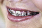 Orthodontic2