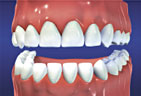 Orthodontic4